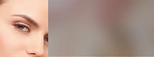 医療アートメイク